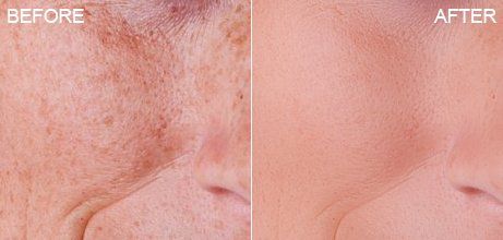 人像修图助手 PT Portrait 6 中文汉化工作室版