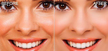 人像修图助手 PT Portrait 6 中文汉化工作室版